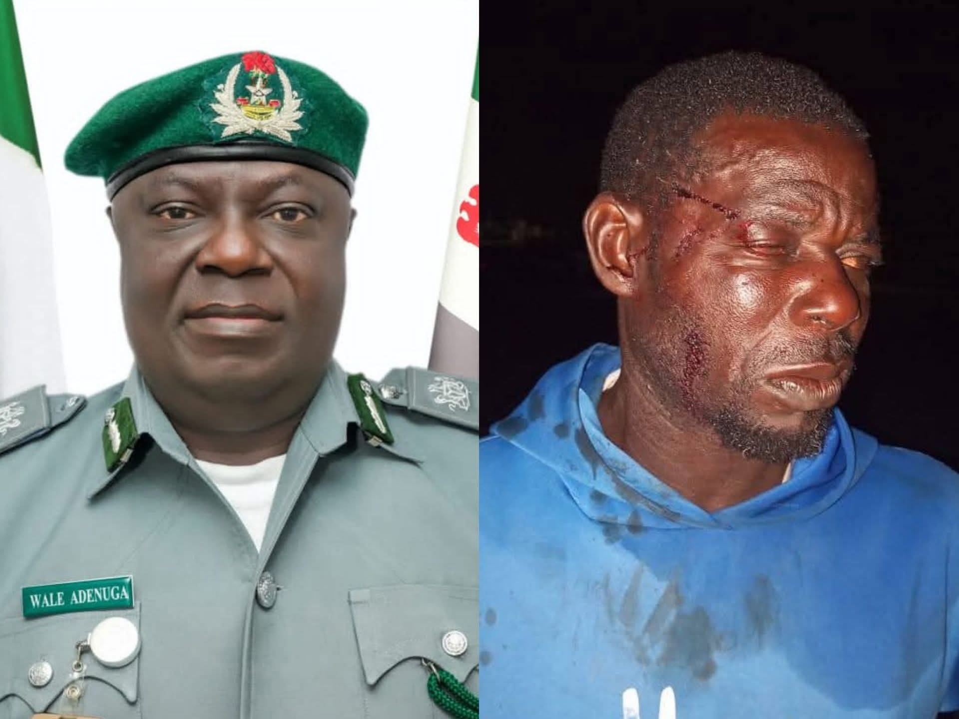 Customs Boss Provides Compensation to Assault Victim at Badagry Checkpoints, Punishes Officers as Soldier Found Culpable